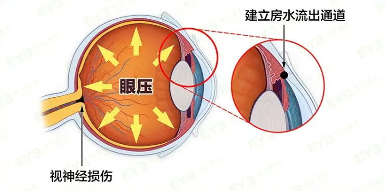 4fcc39b1-a140-4308-a066-1c2fafbb2d74.png